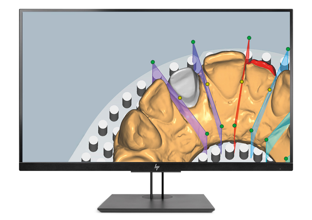 Ceramill M-Build – Fabricating digital models