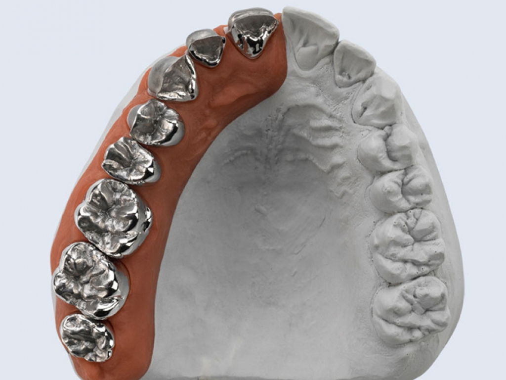 Ceramill Sintron – Revolutionary CoCr processing - Image 3