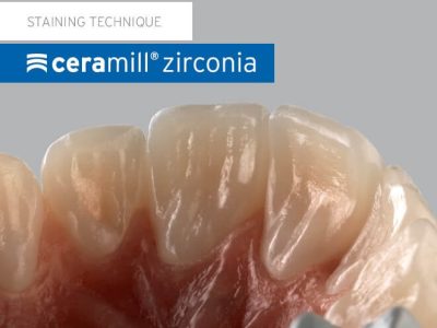 ceramill_zirconia